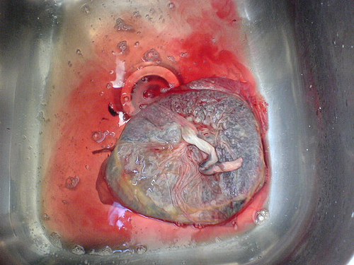 cleaning the placenta